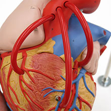 人体模型　心臓/バイパス付,2倍大,4分解　詳細画像