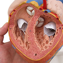 人体模型　心臓/バイパス付,2倍大,4分解　詳細画像
