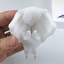 人体模型　気管支樹CTモデル/肺・喉頭部付　詳細画像