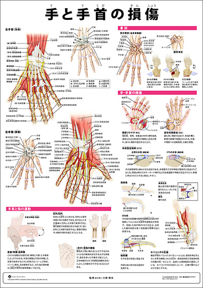 人体解剖図（人体図）　ミニポスター　手と手首の損傷