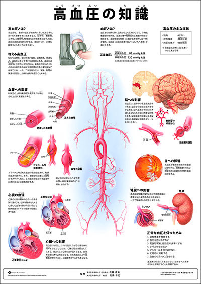 人体解剖図(人体図) ミニポスター 高血圧の知識