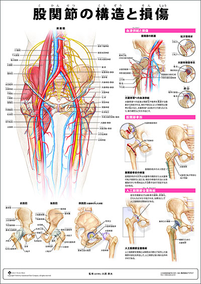 人体解剖図（人体図）　ミニポスター　股関節の構造と損傷
