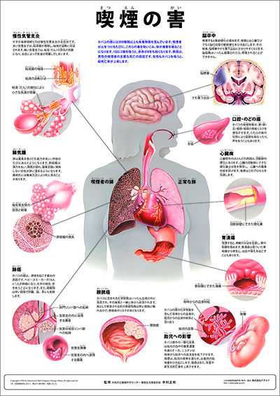 人体解剖図(人体図) ミニポスター 喫煙の害