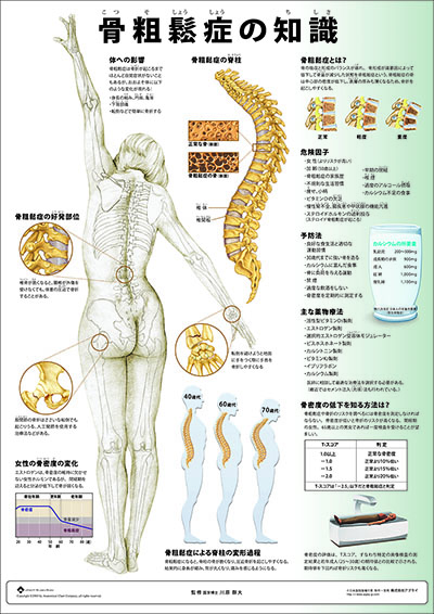人体解剖図（人体図）　ミニポスター　骨粗鬆症の知識