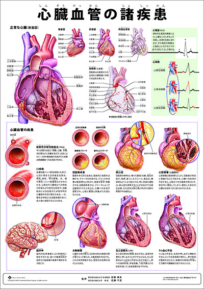 人体解剖図（人体図）　ミニポスター　心臓血管の諸疾患