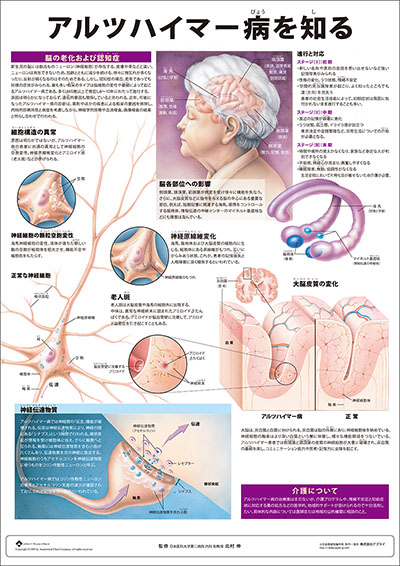 人体解剖図（人体図）　ミニポスター　アルツハイマー病を知る