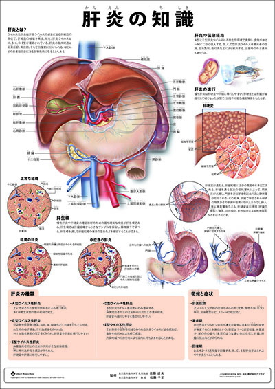 人体解剖図(人体図) ミニポスター 肝炎の知識