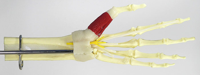 人体模型　手と手首/手根管症候群表示　詳細画像01