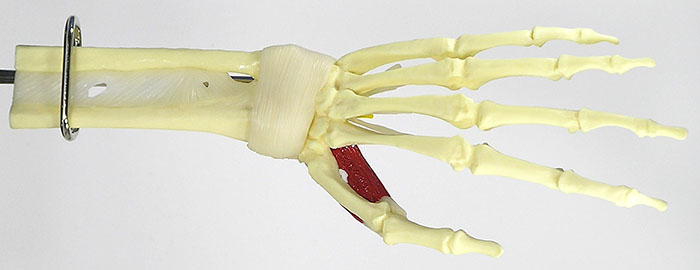 人体模型　手と手首/手根管症候群表示　詳細画像02