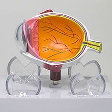 医学模型　眼球断面と角膜疾患　詳細画像01