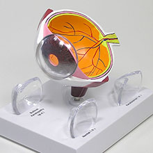医学模型　眼球断面と角膜疾患　詳細画像03
