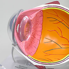 医学模型　眼球断面と角膜疾患　詳細画像06