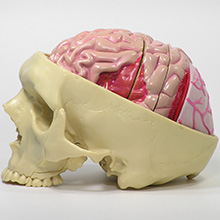 人体模型　脳/頭蓋,諸疾患付　詳細画像01