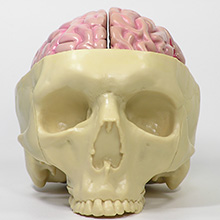 人体模型　脳/頭蓋,諸疾患付　詳細画像02