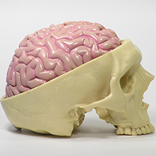 人体模型　脳/頭蓋,諸疾患付　詳細画像03