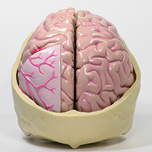 人体模型　脳/頭蓋,諸疾患付　詳細画像04
