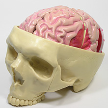 人体模型　脳/頭蓋,諸疾患付　詳細画像05