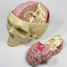 人体模型　脳/頭蓋,諸疾患付　詳細画像06