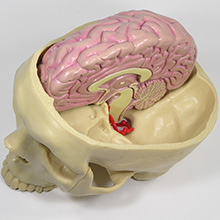 人体模型　脳/頭蓋,諸疾患付　詳細画像07