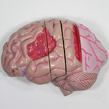 人体模型　脳/頭蓋,諸疾患付　詳細画像06