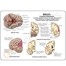 人体模型　脳/頭蓋,諸疾患付　詳細画像08