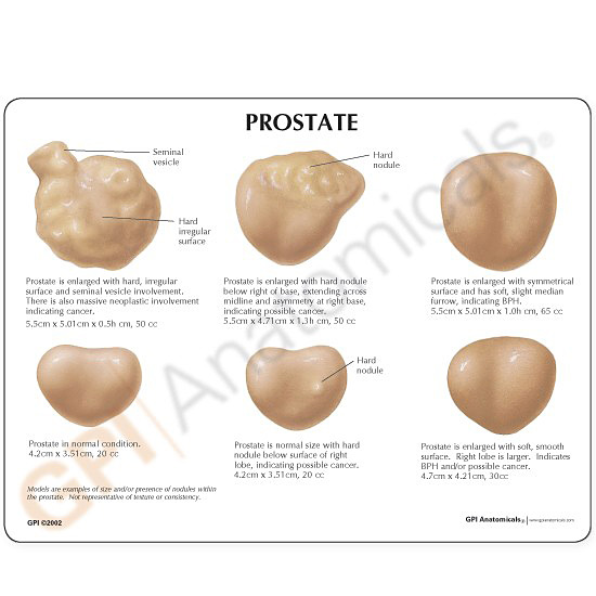 prostate-normal-histology-nus-pathweb-nus-pathweb