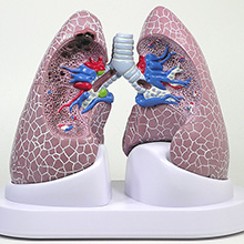 医学模型　肺の主要疾患　詳細画像01
