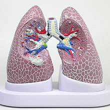 医学模型　肺の主要疾患　詳細画像02