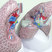医学模型　肺の主要疾患　詳細画像06