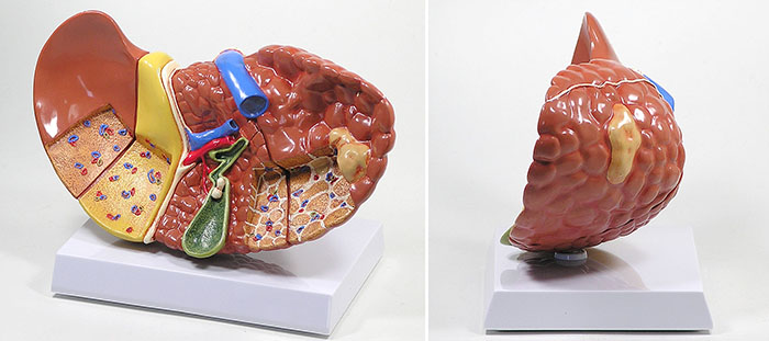 人体模型　肝臓と諸疾患　詳細画像01
