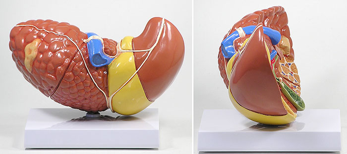 人体模型　肝臓と諸疾患　詳細画像02