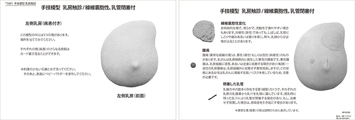 手技模型　乳房触診/線維嚢胞性，乳管閉塞付　詳細画像02