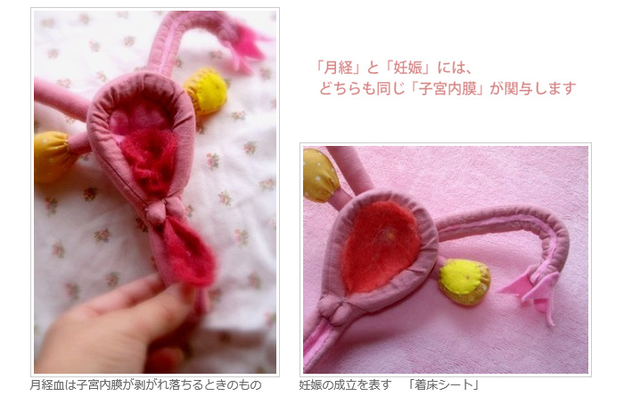 子宮モデル使用イメージ