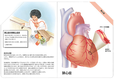 型抜き絵本 冠状動脈疾患 05-06ページ
