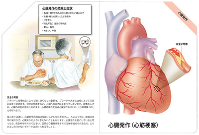 型抜き絵本 冠状動脈疾患 07-08ページ