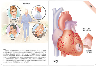 型抜き絵本 冠状動脈疾患 09-10ページ