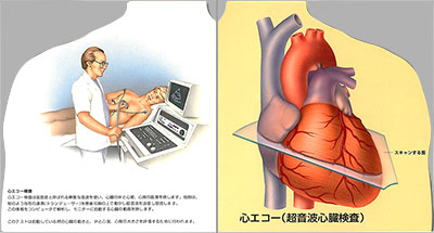 型抜き絵本 心臓「診断法」 05-06ページ