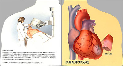 型抜き絵本 心臓「診断法」 09-10ページ