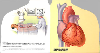 型抜き絵本 心臓「診断法」 11-12ページ