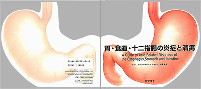 型抜き絵本 胃・食道・十二指腸の炎症と潰瘍 表紙