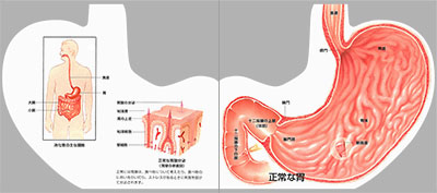 型抜き絵本 胃・食道・十二指腸の炎症と潰瘍 01-02ページ