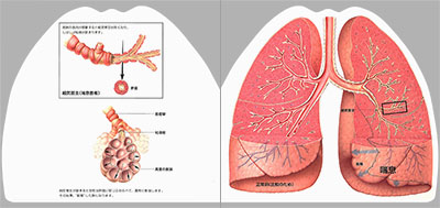 型抜き絵本 慢性閉塞性肺疾患と肺癌 03-04ページ