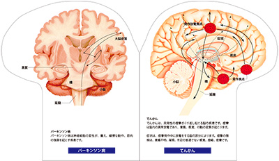 型抜き絵本 ヒトの脳 09-10ページ