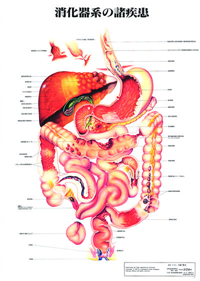 人体解剖図（人体図）　消化器系の諸疾患