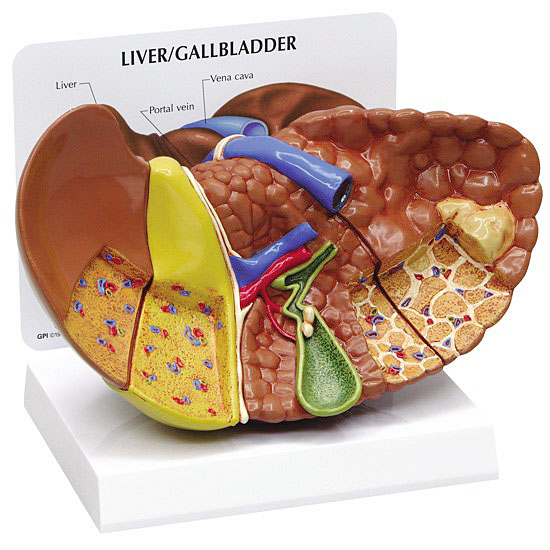 人体模型 肝臓と諸疾患